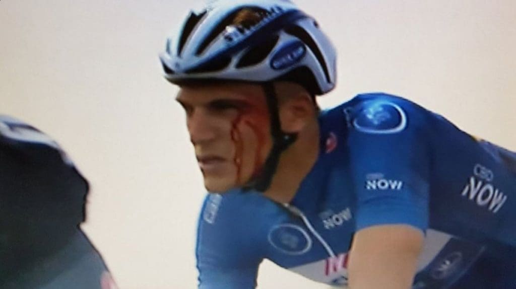 Marcel Kittel after being punched by Andriy Grivko - Tour of Dubai