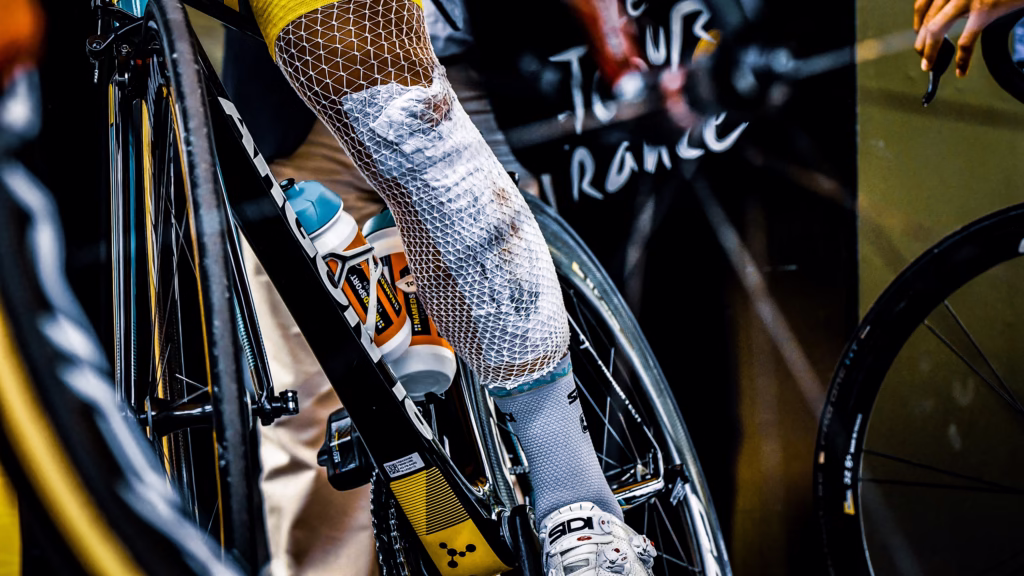 Beyond-the-Peloton-–Health-safety-and-recovery-time-for-athletes-who-have-experienced-significant-trauma-1